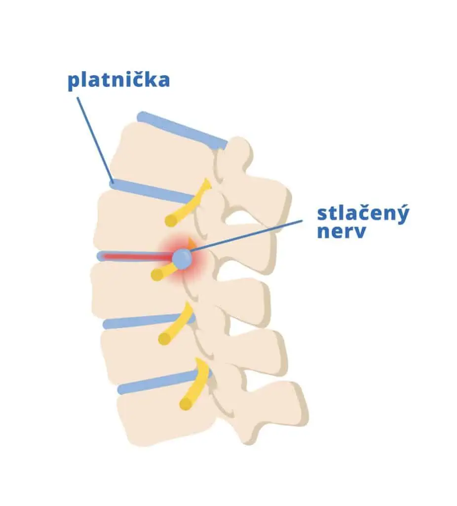 vysunutá platnička