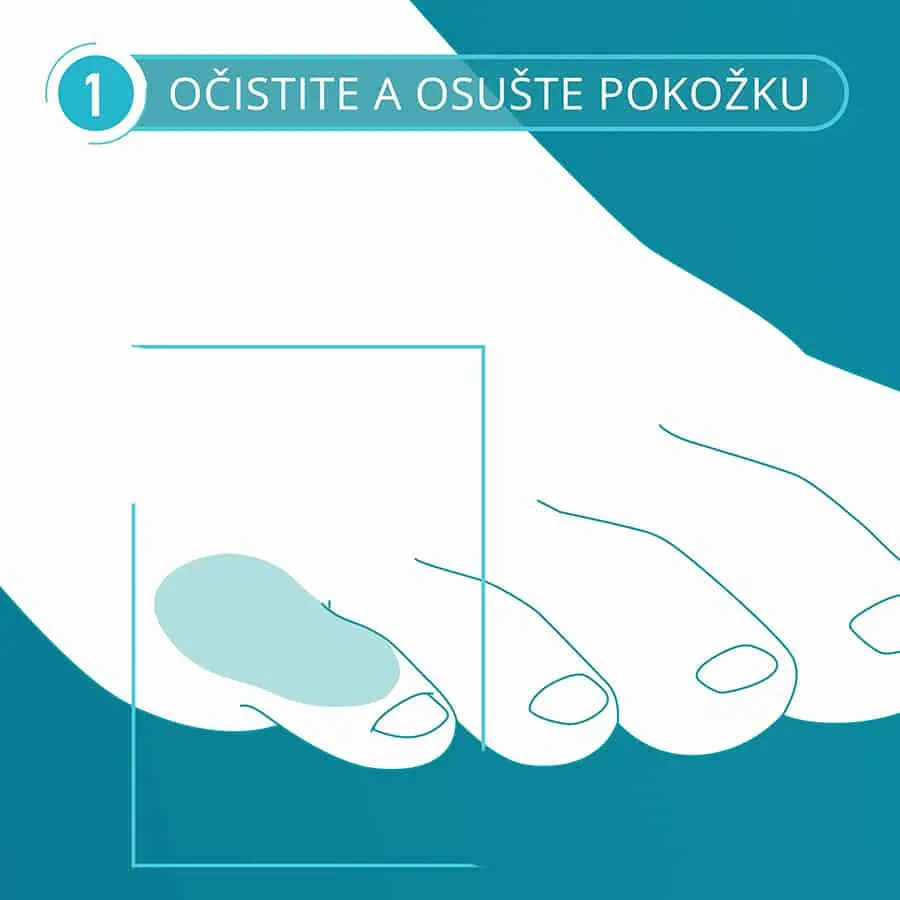 Compeed náplasť na kurie oká - krok 1