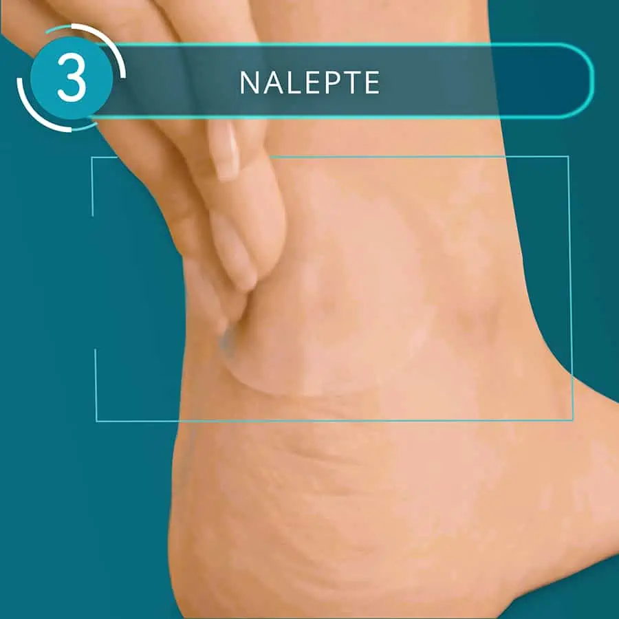 Compeed náplasť na pľuzgiere stredná - krok 3