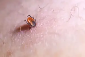 borelioza