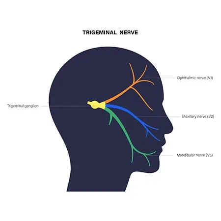 zapal trojklanneho nervu